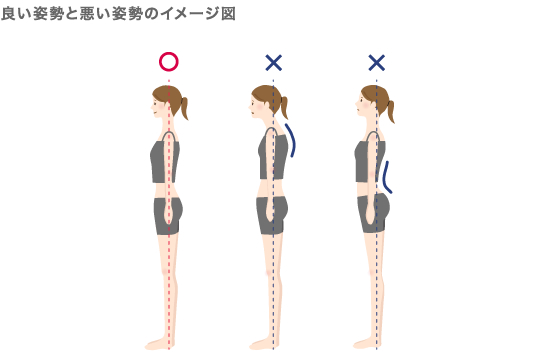 良い姿勢と悪い姿勢のイメージ図