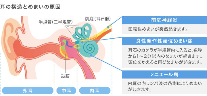 【図：トヨタ記念病院ホームページ内「なるほど健康 耳鳴りとめまい」を参考に作成】