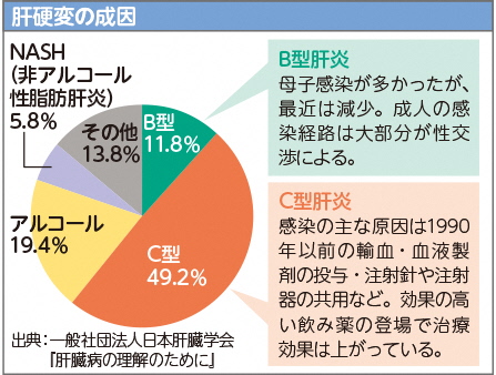 肝硬変の成因