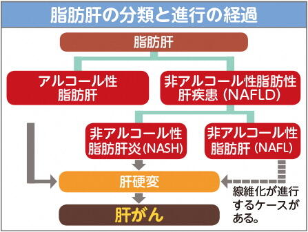 脂肪肝の分類と進行の経過