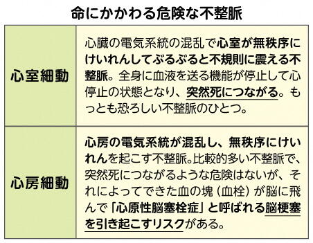 命にかかわる危険な不整