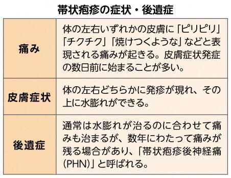 帯状疱疹の症状・後遺症